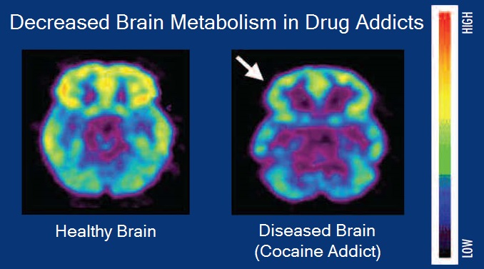 Addiction: after “tagline”, what about “Scores compare research, awareness, complexity, clinical weight,”?