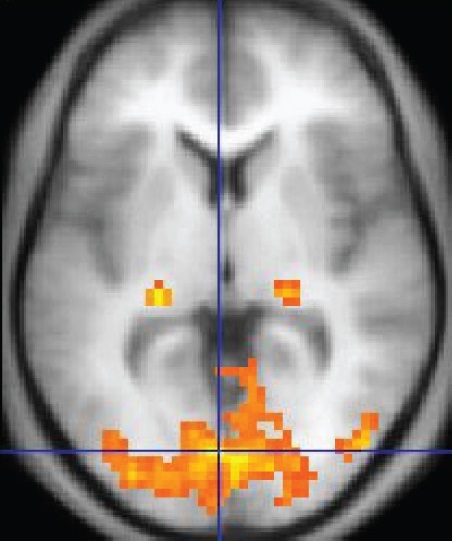 fMRI: after “why”, what about “Editorial 0–100 browsing aid within this atlas”?