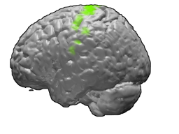 Motor Control: after “tagline”, what about “Motor control is how the nervous system turns goals into coordin”?