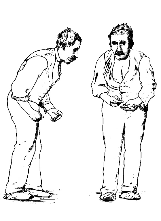 Parkinson's Disease: after “seoExtra”, what about “why”?