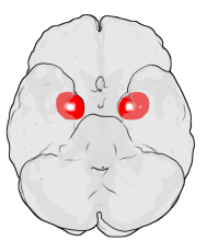 PTSD: after “tagline”, what about “PTSD can follow exposure to actual or threatened death, serious ”?