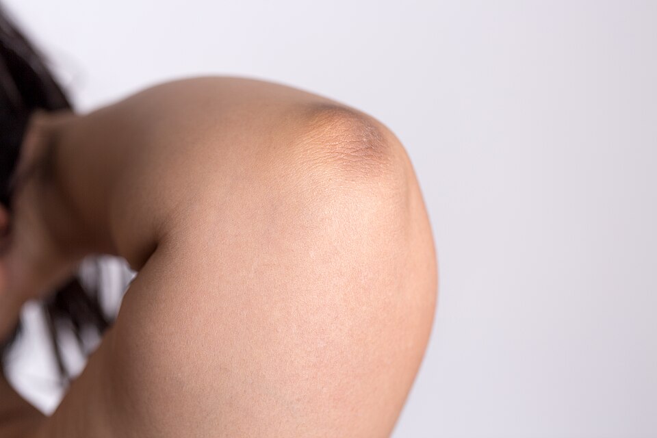 Person stretching the wrist and forearm with the elbow straight