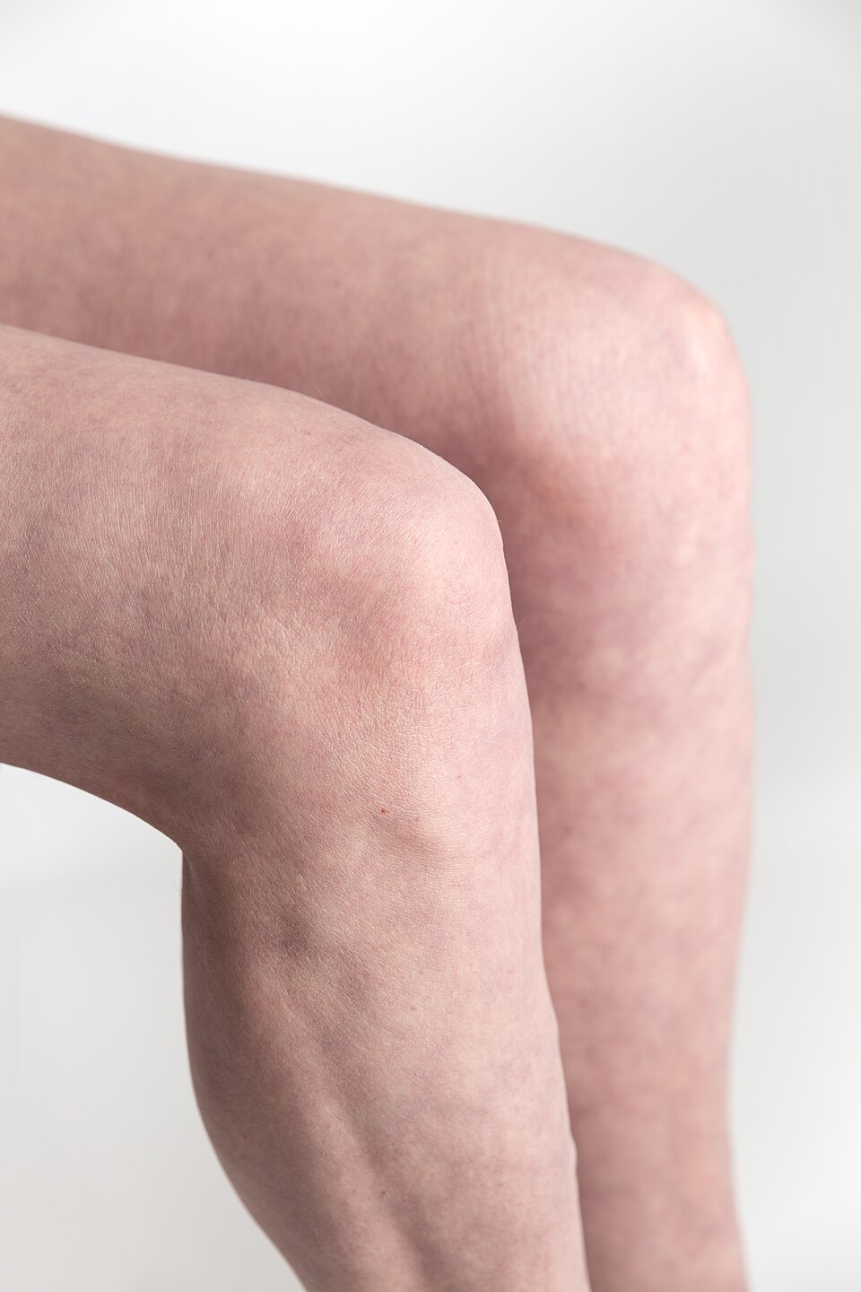 Diagram of the knee joint showing the ligaments and menisci